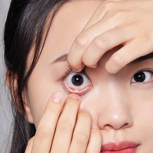 一位女士正在 用2隻手指分別打開上下眼皮及睫毛準備除隱形眼鏡
